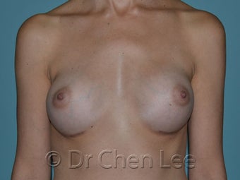 Slim Athletic Body and Breast Type 930266