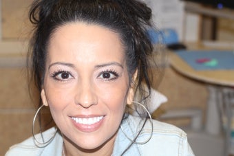 All-on-4 Dental Implants after 1138366