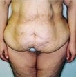 34 year old female patient before 934782