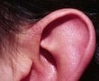 32 year old male patient before 934501