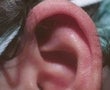 32 year old male patient after 934501