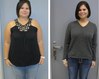 Before & After before 1104586