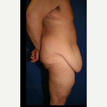 Male Body Lift before 1592953