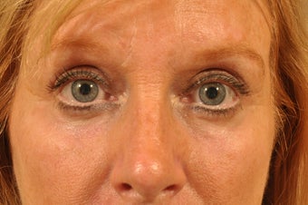 Complete Transformation 857389