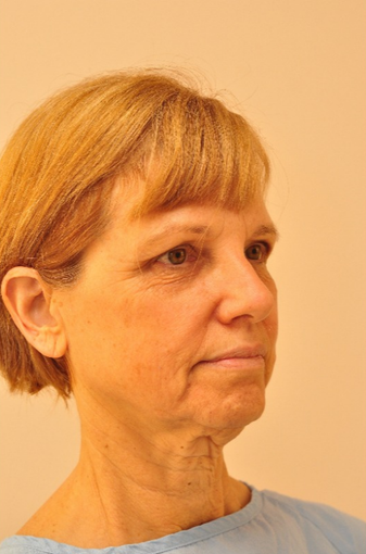 55 y.o. woman who want to look how she feels before 1557603