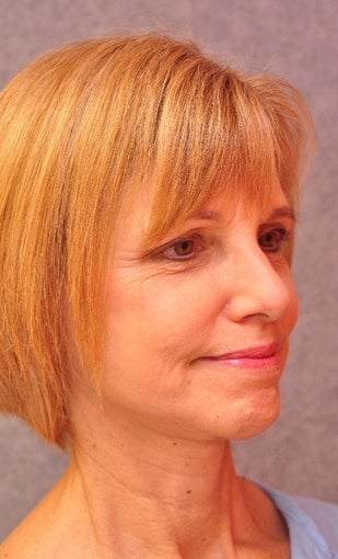 55 y.o. woman who want to look how she feels after 1557603