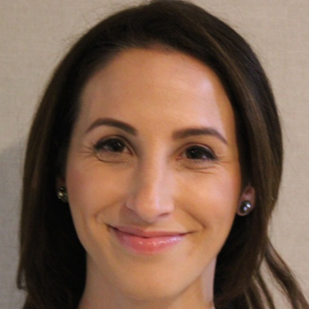 29 year old woman treated with Botox before 3836800