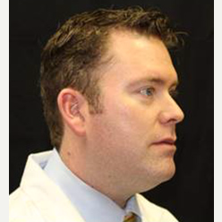 35-44 year old man treated with Kybella before 3588177