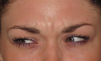 28 year old female for forwn lines before 1389575