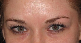 28 year old female for forwn lines after 1389575