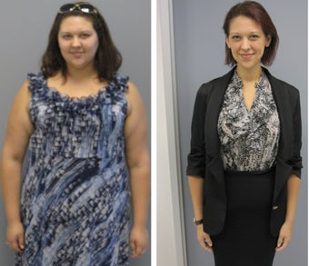 Before & After before 1104611