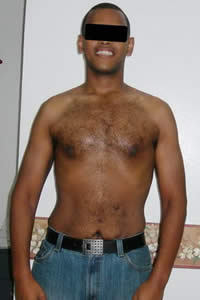 21 year old male Morbidly obese after 1092927
