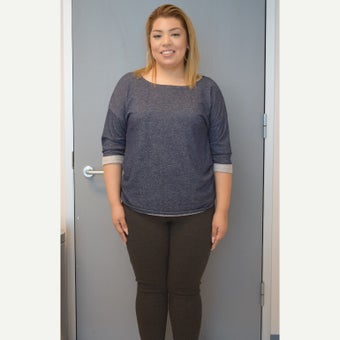 25-34 year old woman treated with Sleeve Gastrectomy after 2551355