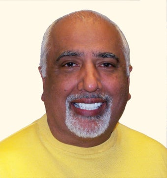 55-64 year old man treated with Hair Transplant before 3658872