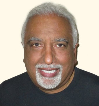 55-64 year old man treated with Hair Transplant after 3658872
