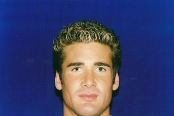 Revision Rhinoplasty after 229780