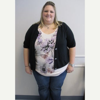 35-44 year old woman treated with Gastric Bypass before 2002176