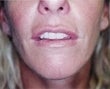 40 year old female patient after 943624