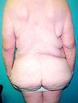 62 year old female patient 944274