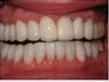 Whiter Smile 292202