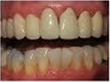 Whiter Smile 292202