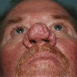 56 year old male patient 944310
