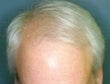 49 year old male patient 926428