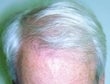 49 year old male patient 926428