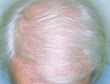 49 year old male patient after 926428