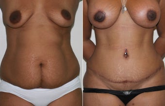 32 yr old mother of two after 1223679