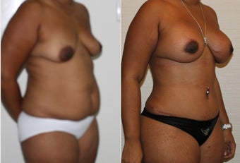 32 yr old mother of two 1223679