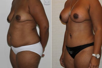 32 yr old mother of two before 1223679