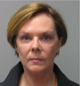 67 year old woman treated with Facelift after 3282880