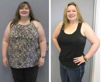 Before & After before 1104601