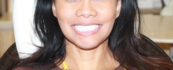 All-on-4® Treatment Protocol after 1222175