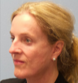 55 year old woman treated with Facelift after 3282902