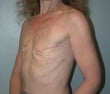 54 year old female patient 925339