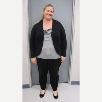 35-44 year old woman treated with Sleeve Gastrectomy before 2562357