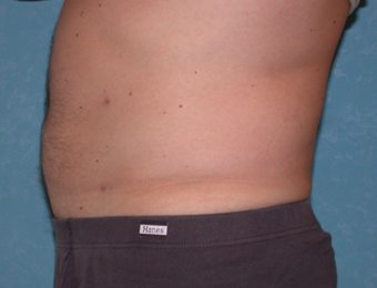 Works out and watches what he eats, was frustrated with belly after 3731747