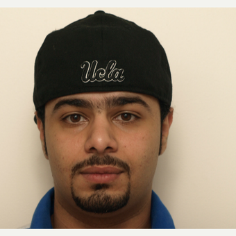 18-24 year old man treated with Revision Rhinoplasty before 3583693