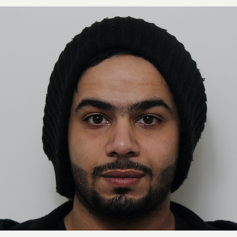 18-24 year old man treated with Revision Rhinoplasty after 3583693