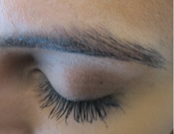 Latisse - Eyelash Growth after 1305552