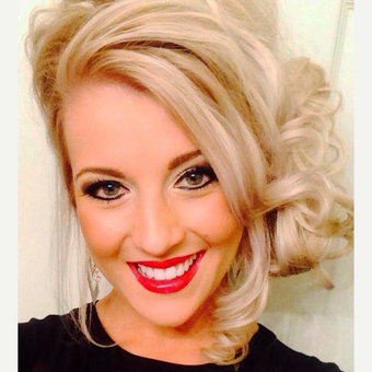 18-24 year old woman treated with Porcelain Veneers after 2699884