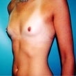 20 year old female patient 943855