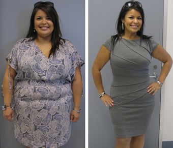 Before & After before 1104598