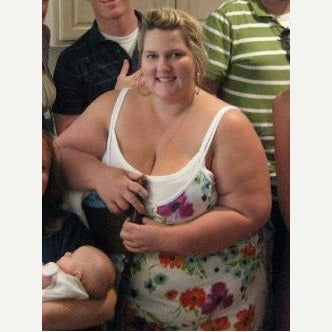 Gastric Bypass Results before 2080584