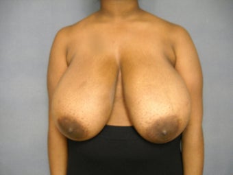 Age: 20, Height: 5"3", Weight: 184lbs. before 879422
