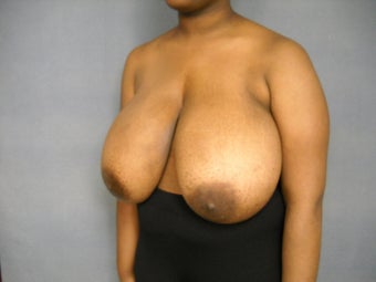Age: 20, Height: 5"3", Weight: 184lbs. 879422