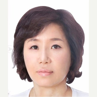 45-54 year old woman treated with SMAS Facelift/eyelid surgery/nasolabial folds surgery. after 2030765