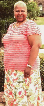 Gastric Sleeve Procedure helps woman loose over 100 pounds before 2315406